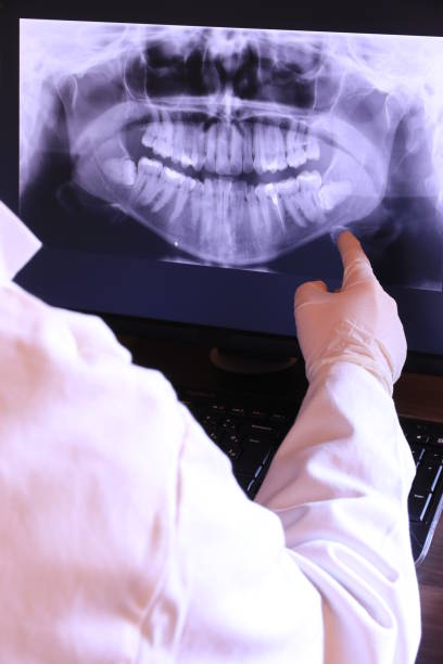 Best Emergency Wisdom Teeth Removal in Johnson Lane, NV