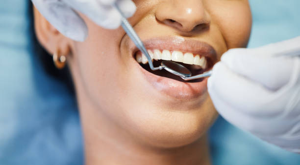 Best Emergency Treatment for Dental Infections or Abscesses in Johnson Lane, NV